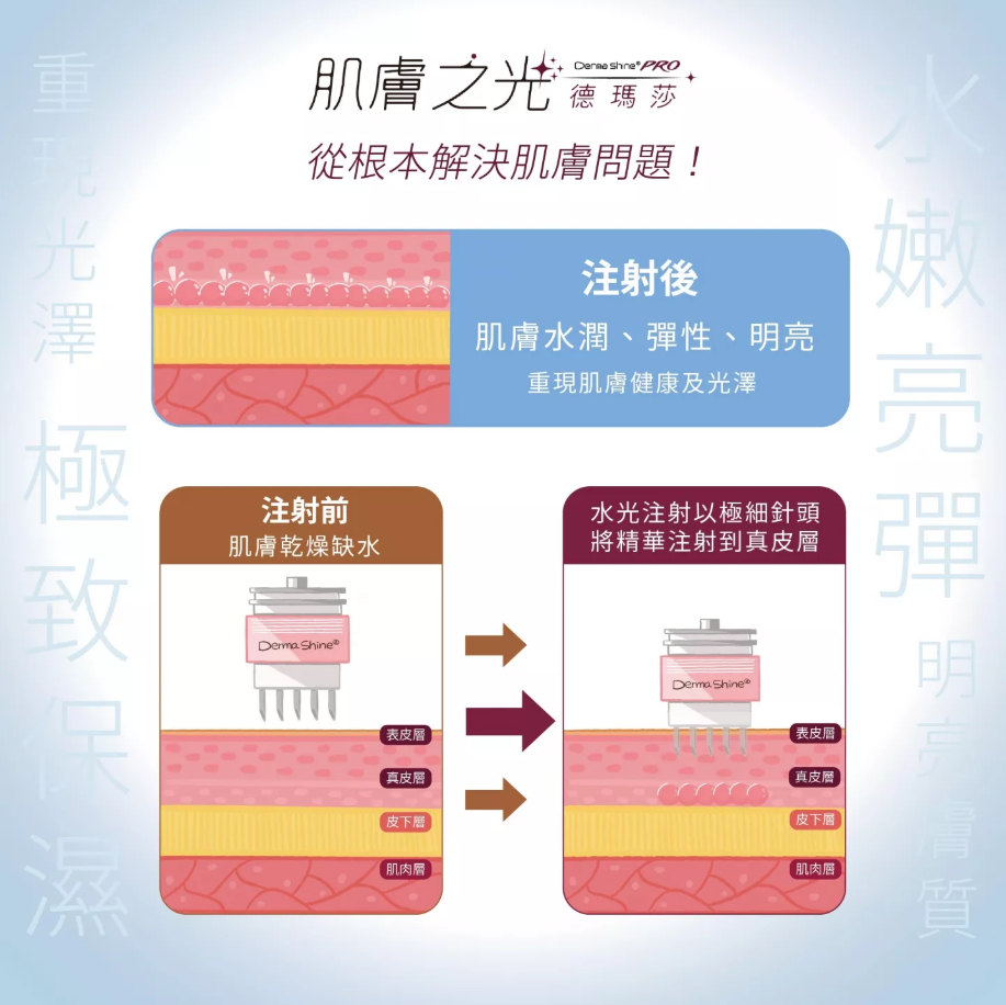 德瑪莎肌膚之光治療過程