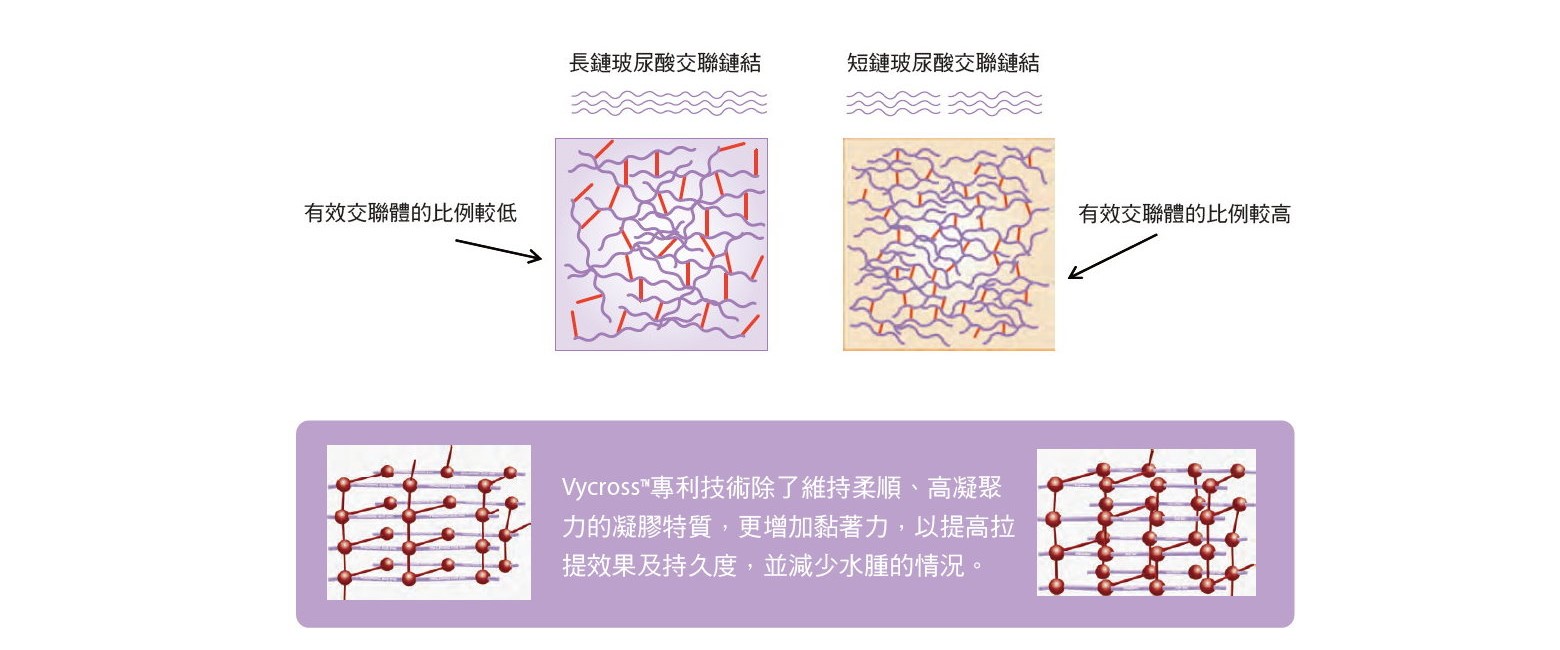 分層美學注射規劃