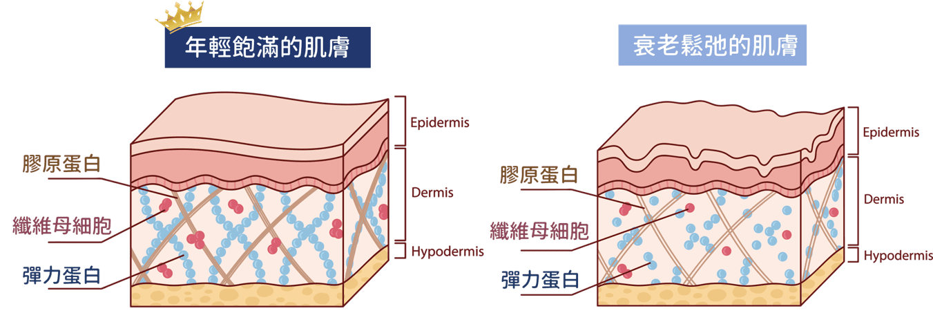 PROFHILO NAHYCO 技術示意圖